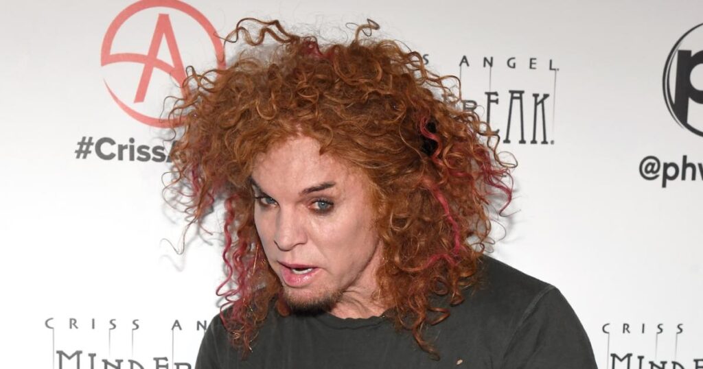 Carrot Top’s Rep Gives Update on Comedian’s Condition Amid Hospitalization After Alleged Suicide Attempt